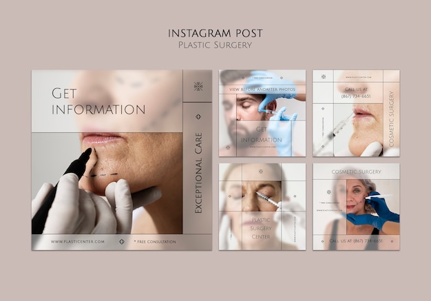 Posty Na Instagramie Dotyczące Chirurgii Plastycznej