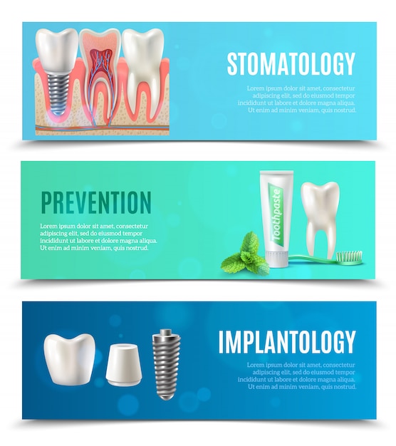 Dental Implants 3 Horizontal Banners Set