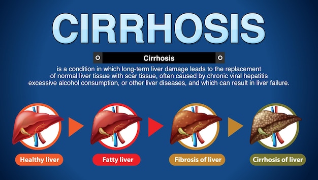 Etapy Infografiki Uszkodzenia Wątroby