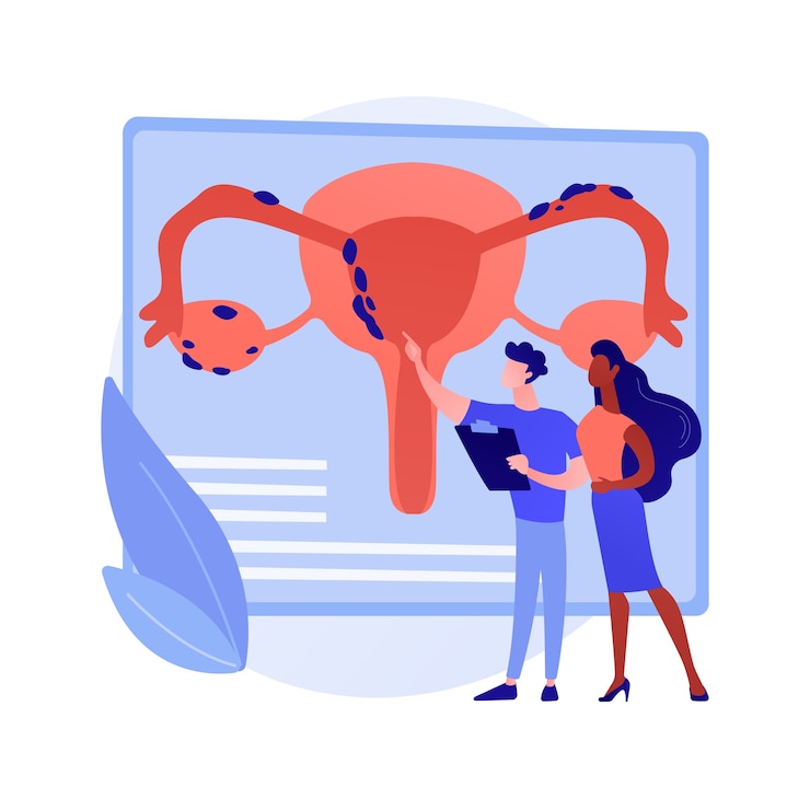 Bezpłatny plik Wektor ilustracja wektorowa abstrakcyjna koncepcja endometriozy. dysfunkcja endometrium, poradnia ginekologiczna, diagnostyka i leczenie endometriozy, abstrakcyjna metafora funkcji rozrodczych kobiet.