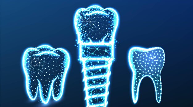 Implant dentystyczny zęba Abstrakcyjna konstrukcja szkieletowa Low Poly Mesh Design Vector Illustration