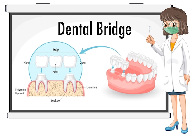 Infografika Człowieka W Moście Dentystycznym Na Białym Tle