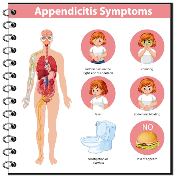 Infografika Informacji O Objawach Zapalenia Wyrostka Robaczkowego