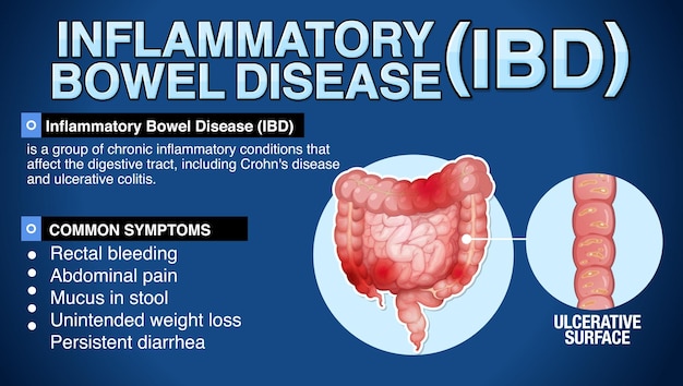 Bezpłatny wektor nieswoiste zapalenie jelit ibd infografika