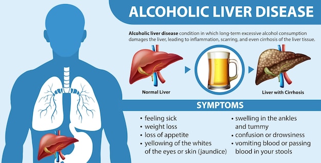 Bezpłatny wektor plakat informacyjny alkoholowej choroby wątroby marskość wątroby