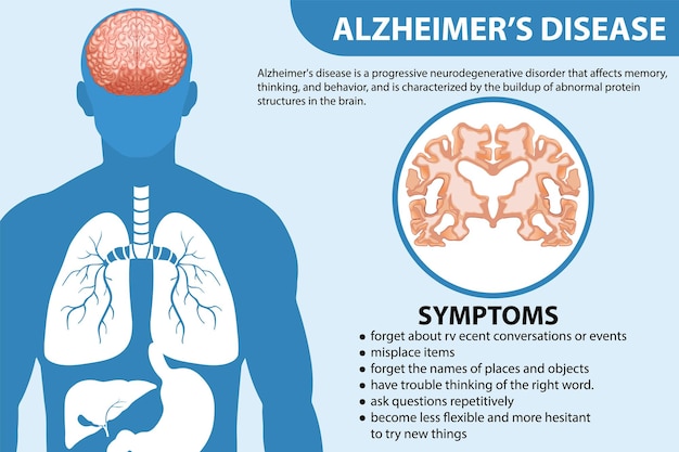 Bezpłatny wektor plakat informacyjny choroby alzheimera