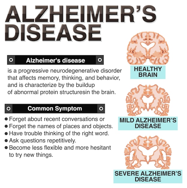 Bezpłatny wektor plakat informacyjny choroby alzheimera