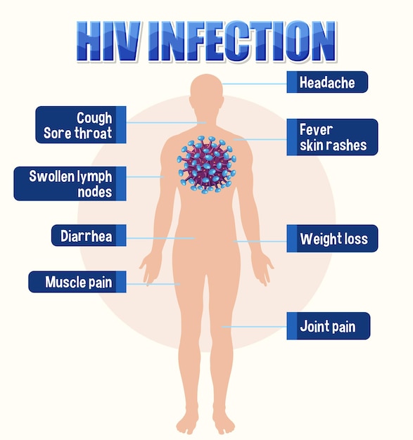 Plakat informacyjny o zakażeniu wirusem HIV
