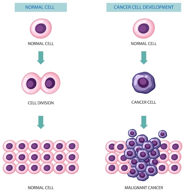 Bezpłatny wektor proces rozwoju komórek rakowych