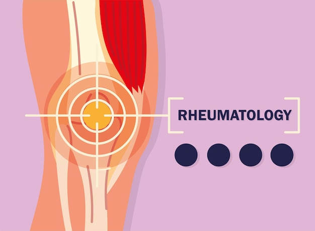 Projekt reumatologiczny bólu kolana
