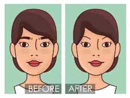 Bezpłatny wektor przed i po zabiegu usuwania włosów