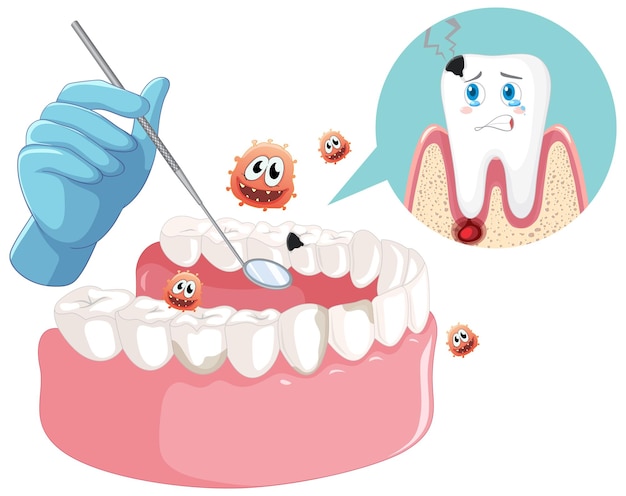 Ręka Dentysty Z Modelem Próchnicy Zębów