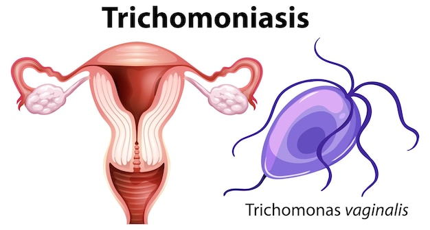 Bezpłatny wektor trichomonas vaginalis na białym tle