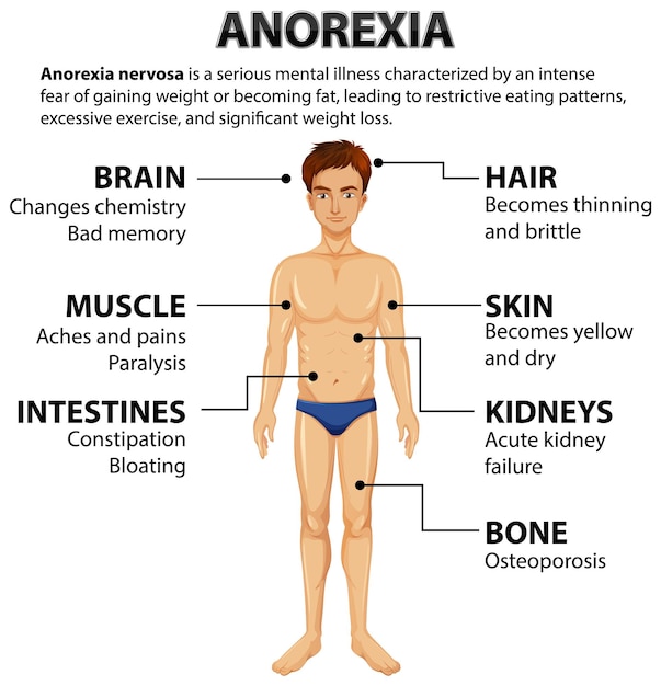 Bezpłatny wektor wpływ anoreksji na anatomię mężczyzn