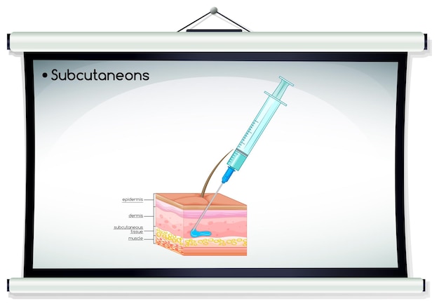 Bezpłatny wektor wstrzyknięcie podskórne na ludzką skórę