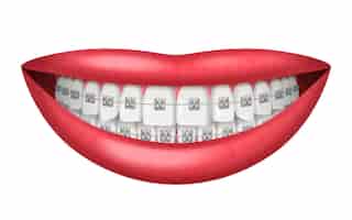 Bezpłatny wektor zęby aparat ortodontyczny realistyczne izolowane na białym tle ilustracji wektorowych