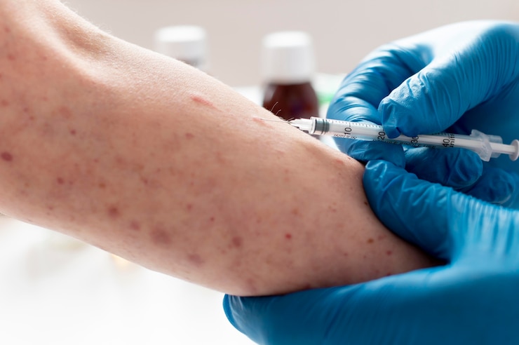 Bezpłatny plik Zdjęcie alergia skórna na ramieniu osoby