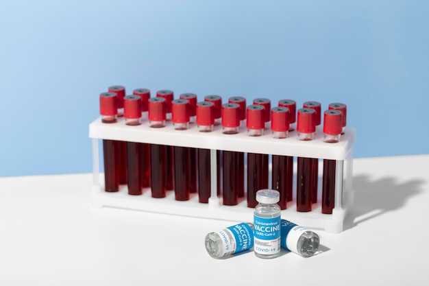 Asortyment koronawirusa z próbkami krwi i szczepionką