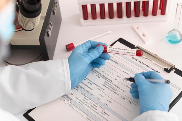 Asortyment próbek krwi koronawirusa w laboratorium
