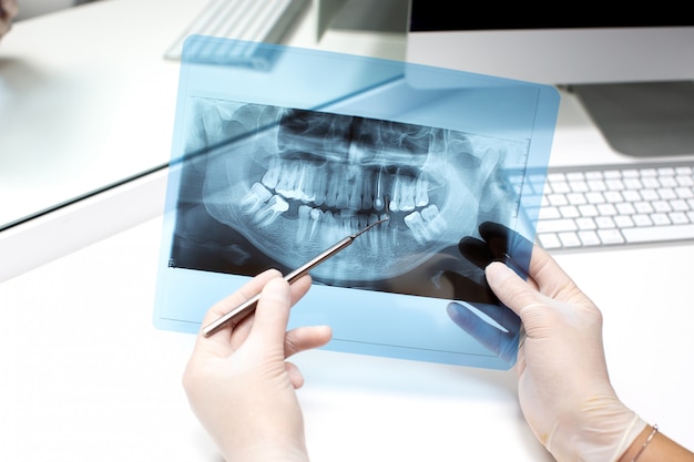 Dentysta analizuje zdjęcie rentgenowskie