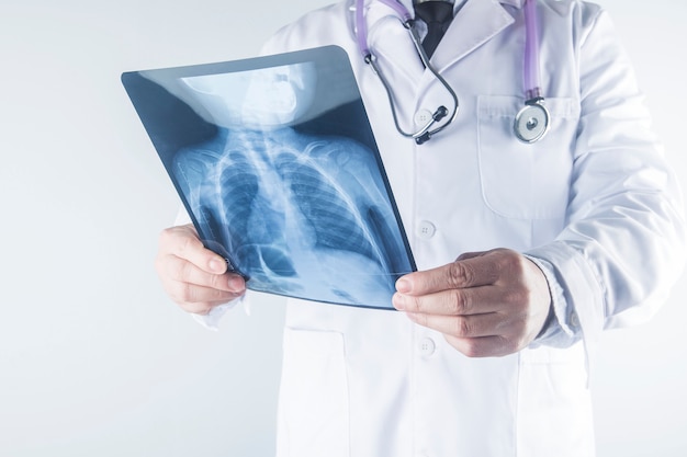 Doktorski egzamininuje klatki piersiowej promieniowania rentgenowskiego film pacjent przy szpitalem.