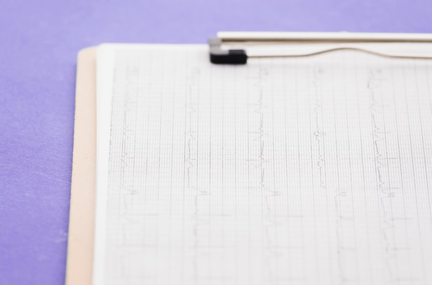 Kardiogram; EKG wykres w schowku na fioletowym tle