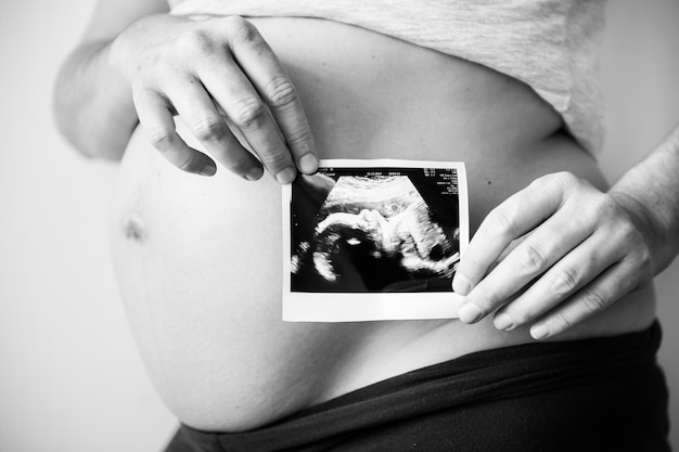 Kobieta W Ciąży Pokazuje Płodu Ultradźwięku Fotografię