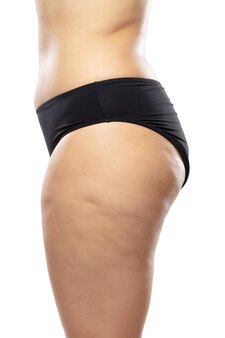Kobieta z nadwagą i cellulitem na nogach i pośladkach, otyłość kobiecego ciała w czarnej bieliźnie