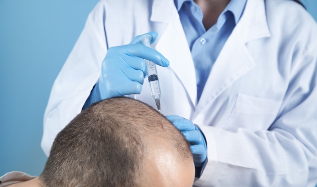 Lekarz wykonuje zastrzyk w głowę mężczyzny na porost włosów.