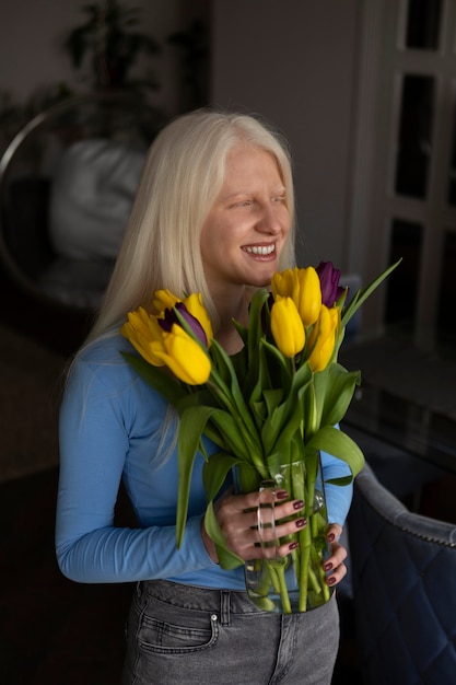 Bezpłatne zdjęcie młoda kobieta z albinizmem i kwiatami tulipanów