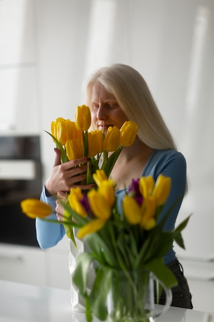 Młoda kobieta z albinizmem i kwiatami tulipanów