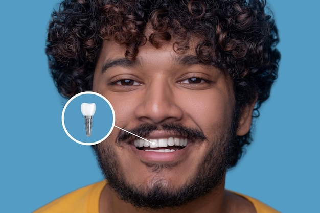 Młody mężczyzna z uśmiechem zębów demonstrujący swój implant dentystyczny