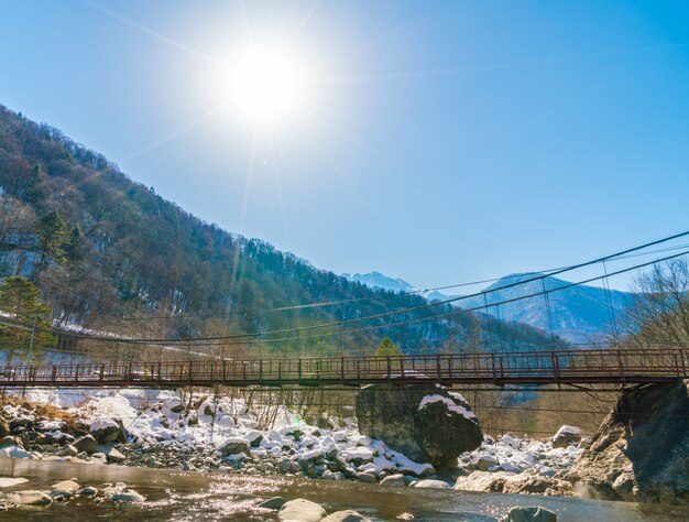 Odkryty Onsen, Japonia