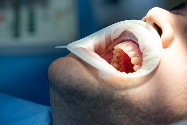 Pacjent w klinice dentystycznej podczas operacji