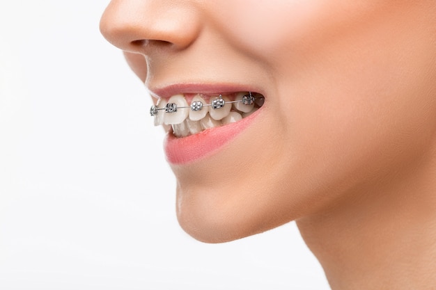 Bezpłatne zdjęcie piękna młoda kobieta z zębów szelkami