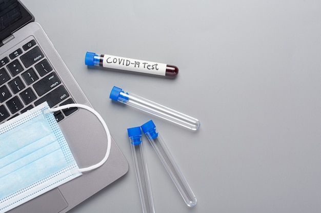 Probówka z próbką krwi do testu COVID-19