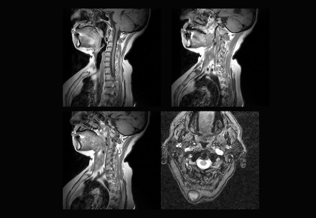 Profesjonalne zdjęcia rentgenowskie kręgosłupa szyjnego i tomografia komputerowa