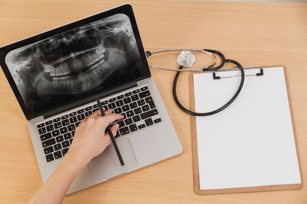 Radiografia na laptopie