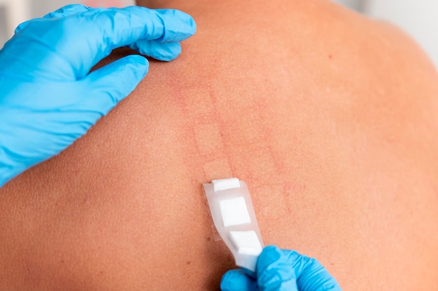 Reakcja alergiczna skóry na plecach osoby
