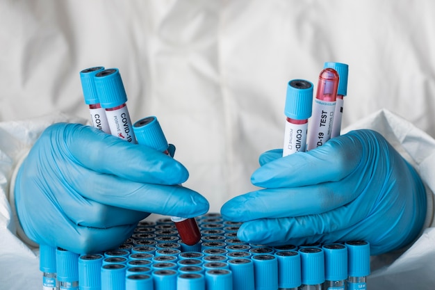 Ręka z rękawicami ochronnymi zawierająca próbki krwi do testu COVID