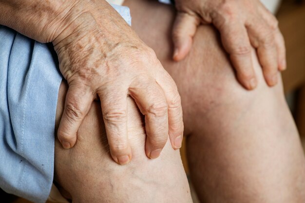 Starsza kobieta cierpi ból kolana