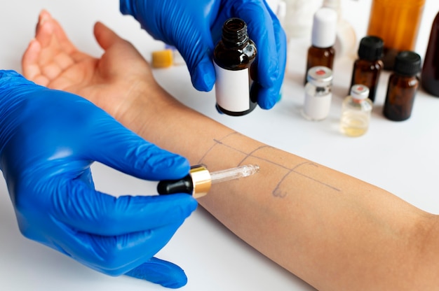Test reakcji alergicznej skóry na ramieniu osoby