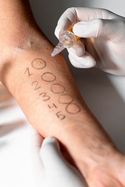 Test reakcji alergicznej skóry na ramieniu