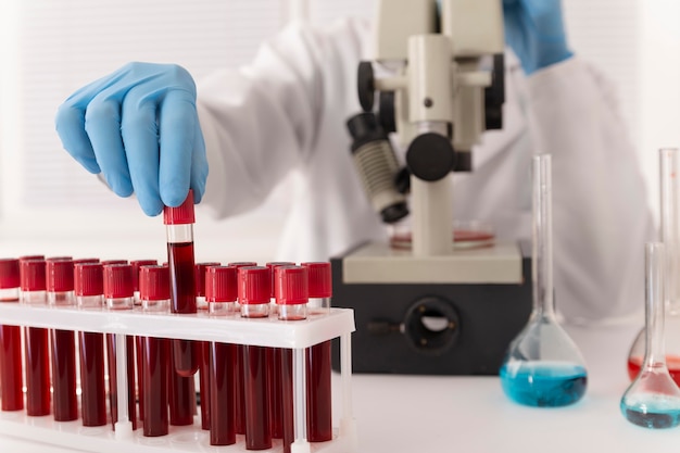 Bezpłatne zdjęcie ułożenie próbek krwi koronawirusa w laboratorium