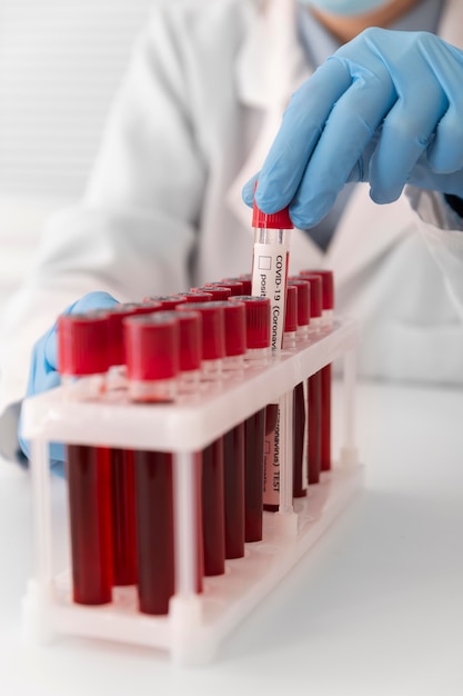 Ułożenie próbek krwi koronawirusa w laboratorium
