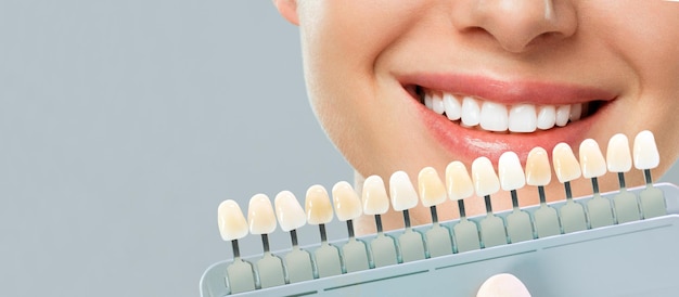 Uśmiechnięta młoda kobieta. kosmetologiczne wybielanie zębów w gabinecie stomatologicznym. dobór tonu zęba implantu.