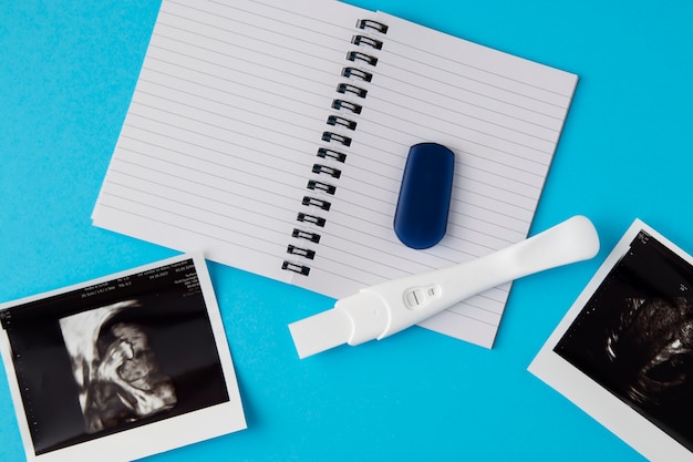 Bezpłatne zdjęcie widok z góry pozytywny test ciążowy i usg