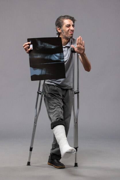 Bezpłatne zdjęcie widok z przodu młody mężczyzna ze złamaną stopą używający kul i trzymający prześwietlenie na szarej podłodze, wyłączający skręcenie stopy po wypadku, złamany ból