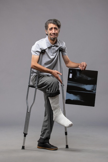 Widok z przodu młody mężczyzna ze złamaną stopą używający kul i trzymający prześwietlenie na szarej ścianie. Ból wyłącza złamaną stopę po wypadku
