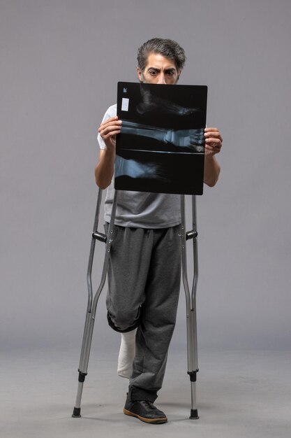 Widok z przodu młody mężczyzna ze złamaną stopą za pomocą kul i trzymający prześwietlenie na szarej ścianie wyłącza złamany ból w razie wypadku skręcenie stopy